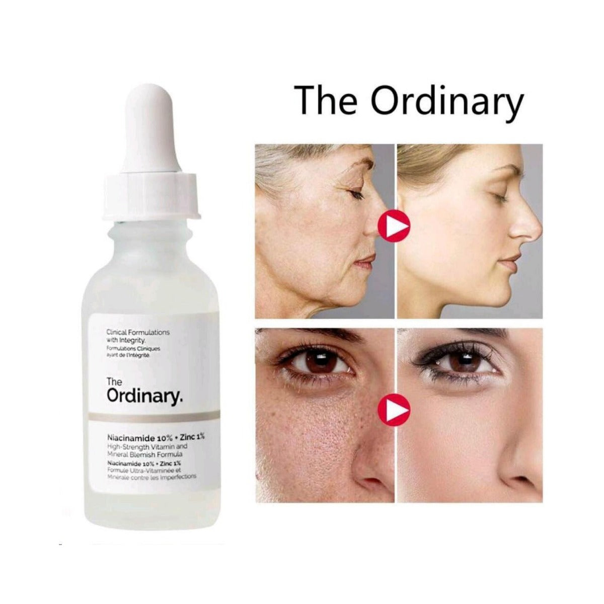 THE ORDINARY NIACINAMIDE 10% + ZINC 1% (30mL)